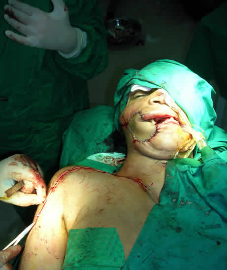 Plastic surgery on young girl at Murshid